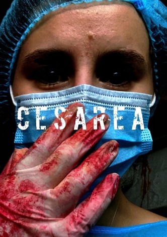Cesárea
