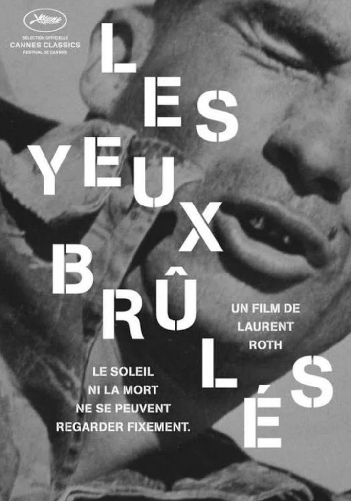 Les yeux brûlés