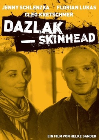 Dazlak – Skinhead