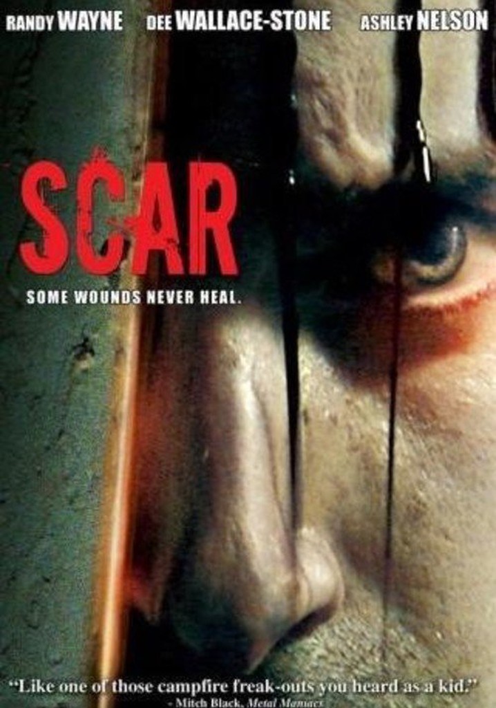 Scar