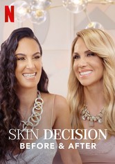 Skin decision: prima e dopo
