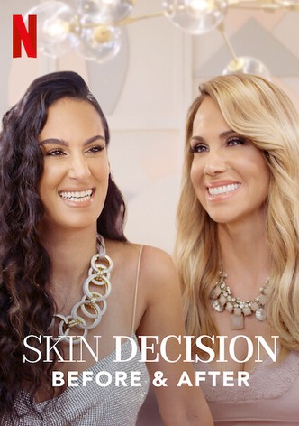 Skin decision: prima e dopo