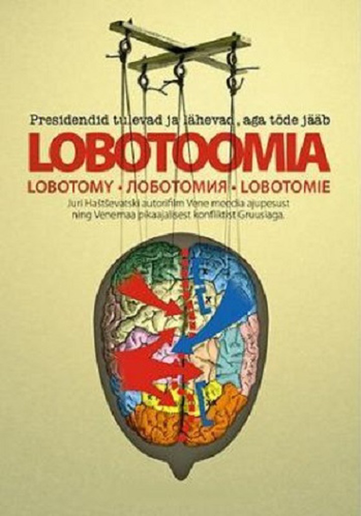 Lobotomy