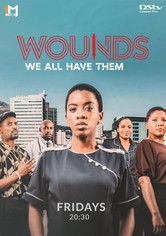 Wounds