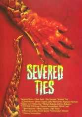 Severed Ties
