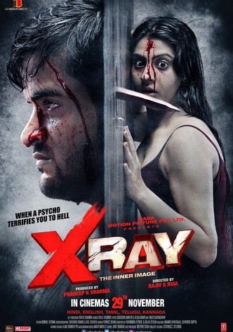 X Ray: The Inner Image