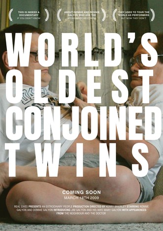 The World's Oldest Conjoined Twins