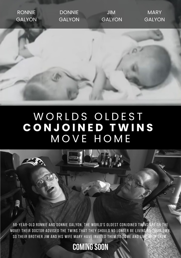 World's Oldest Conjoined Twins Move Home