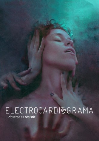 Electrocardiograma