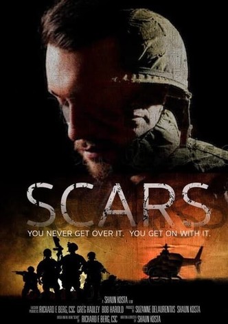Scars