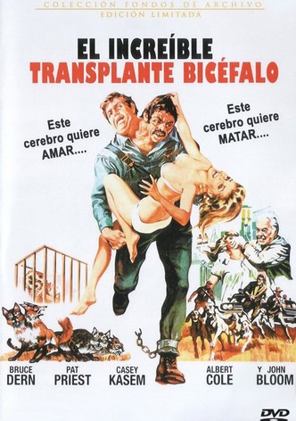 El increíble transplante bicéfalo