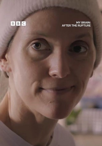 My Brain: After the Rupture