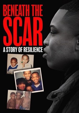 Beneath the Scar: A Story of Resilience