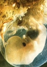 Schwangerschaft und Geburt