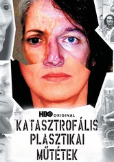 Katasztrofális plasztikai műtétek