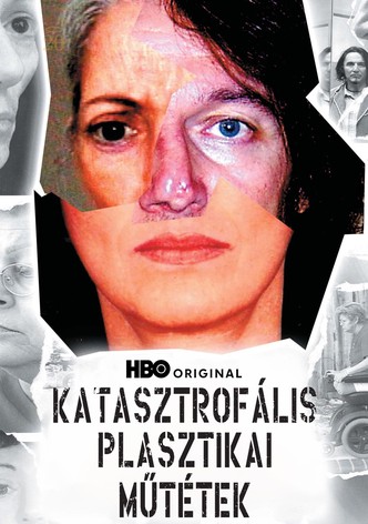 Katasztrofális plasztikai műtétek