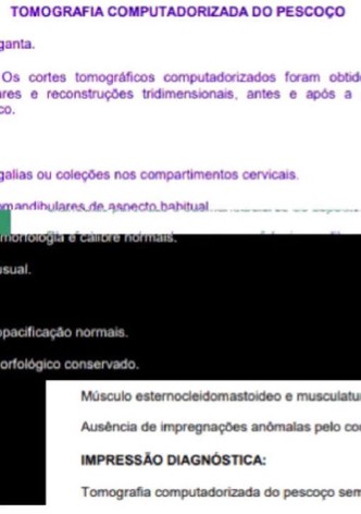 Uma tomografia do meu pescoço