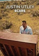 Scars