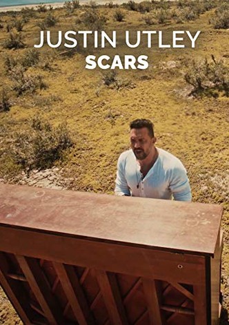 Scars