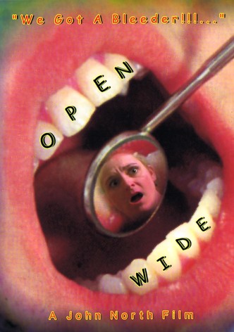 Open Wide