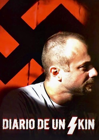 Diario de un skin