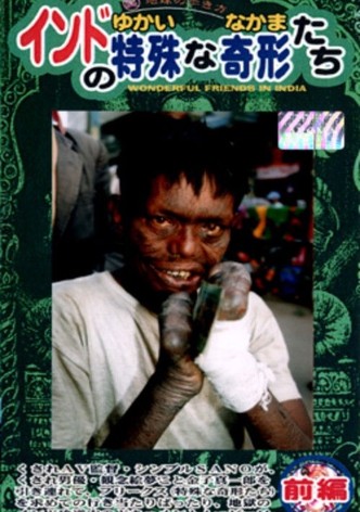 India's Unique Deformed Creatures (The Curious Companions) Part 1