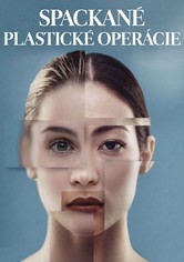 Spackané plastické operácie