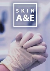 SKIN A&E