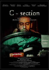 C-section