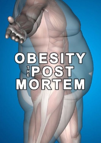 Obesity: The Post Mortem