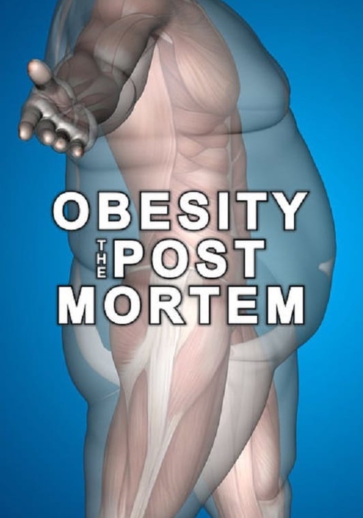Obesity: The Post Mortem